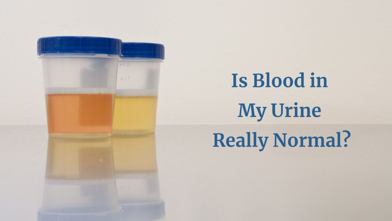 What Does A Trace Of Blood In Urine Mean