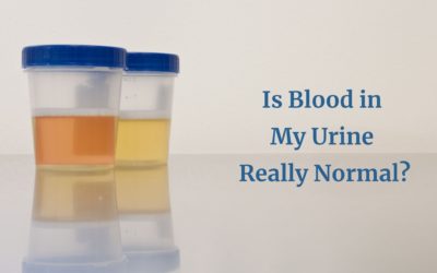 So, Is Blood in My Urine  Really Normal? Bladder Concerns