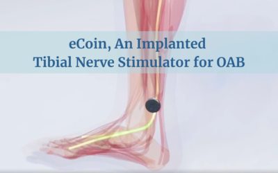 eCoin, An Implanted Tibial Nerve Stimulator for OAB